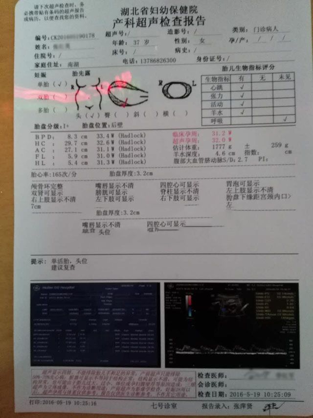 ���ݴ���